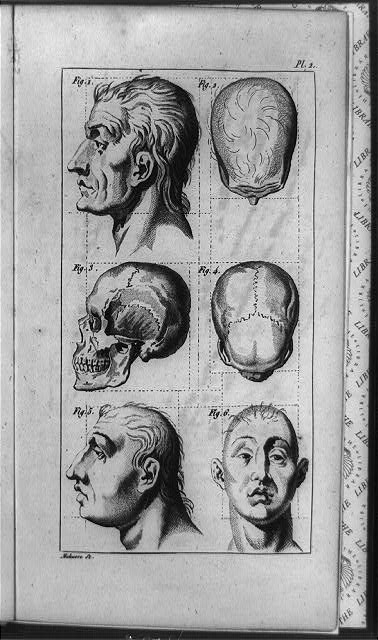 [Cranial shape of skull of sane man in figure 3 and 4...
