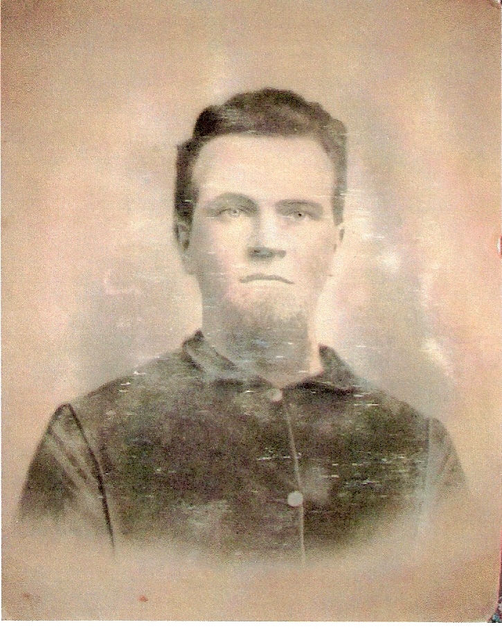 Jesse O Burgess, Union Soilder in the Civil War