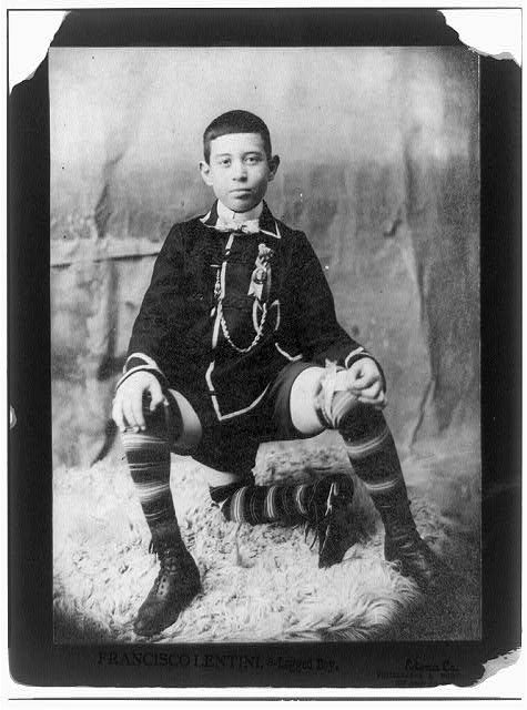 Francisco Lentini, 3-legged boy