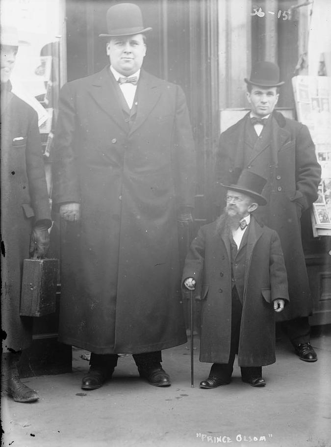 Prince Olsom, Smallest Man | Tallest Man