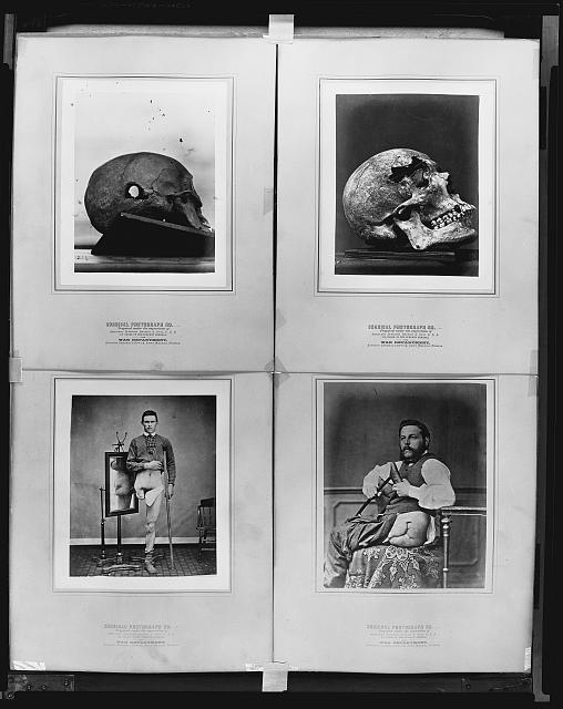 Surgical photograph ... prepared under the supervision of...