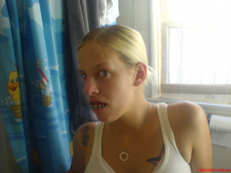 Loy in Hobo teeth